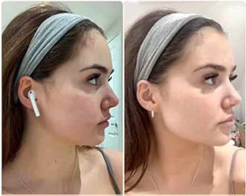 Face Massager ©